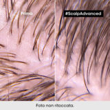 L'Oreal Professionnel Paris Scalp Advanced Anti-Oiliness Shampoo 500ml - shampooing séborégulateur